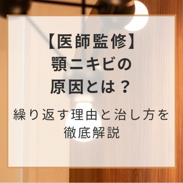 【医師監修】顎(あご)ニキビの原因とは?繰り返す理由と治し方を徹底解説