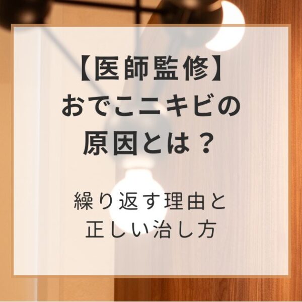 【医師監修】おでこニキビの原因とは?繰り返す理由と正しい治し方