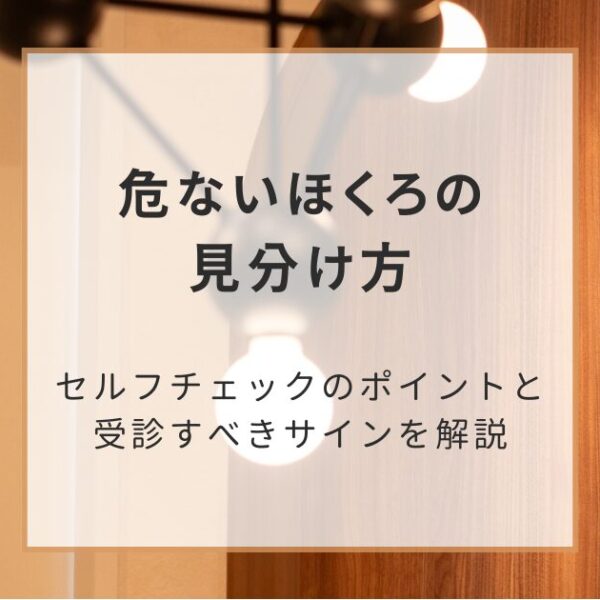危ないほくろの見分け方｜セルフチェックのポイントと受診すべきサインを解説