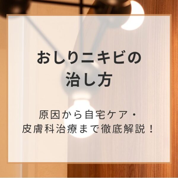 おしりニキビの治し方｜原因から自宅ケア・皮膚科治療まで徹底解説！