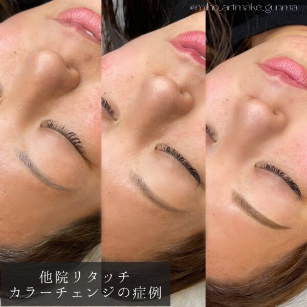 眉アートメイク
