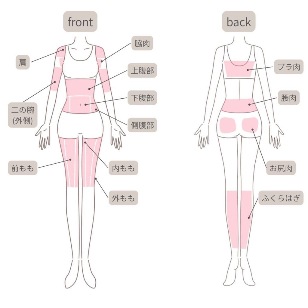 CLINIC W オンダリフト施術可能部位｜全身