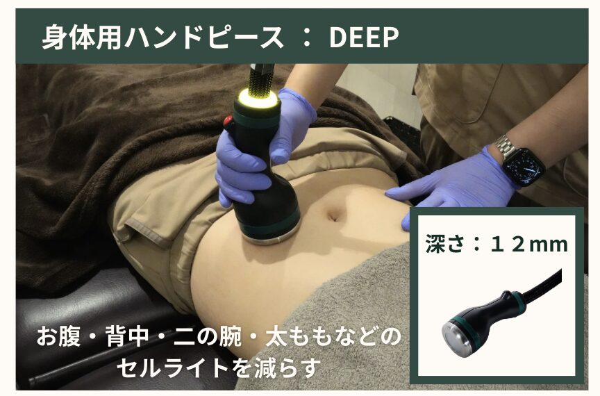 CLINIC W オンダリフト｜ONDA PRO 身体用ハンドピース DEEP