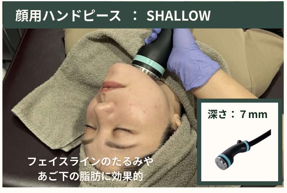 CLINIC W オンダリフト｜ONDA PRO 顔用ハンドピース SHALLOW