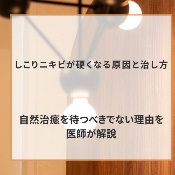 しこりニキビが硬くなる原因と治し方｜自然治癒を待つべきでない理由を医師が解説
