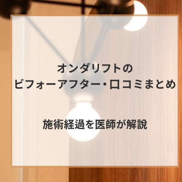 オンダリフトのビフォーアフター・口コミまとめ｜施術経過を医師が解説