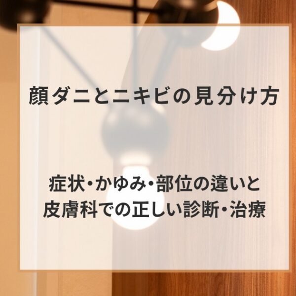 顔ダニとニキビの見分け方｜症状・かゆみ・部位の違いと皮膚科での正しい診断・治療